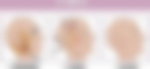 种植毛发的注意事项