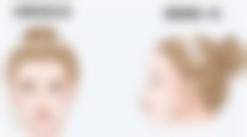 瘦脸针一般管多久有效