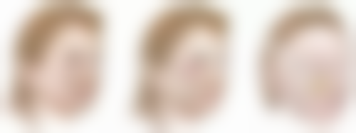 瘦脸针管用多久