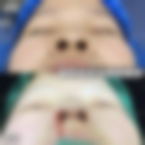 【厦门臻医整形外科门诊部参考价格表:】