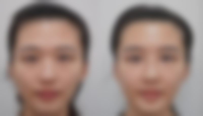 【江利君医生口碑怎么样？】