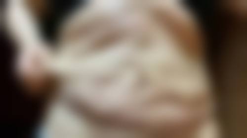 打瘦脸针可以吃下火药吗