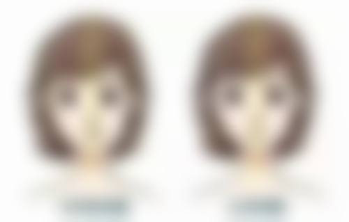 瘦脸针打双下巴成效好吗