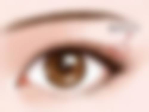 【陈心玉医生擅长项目】