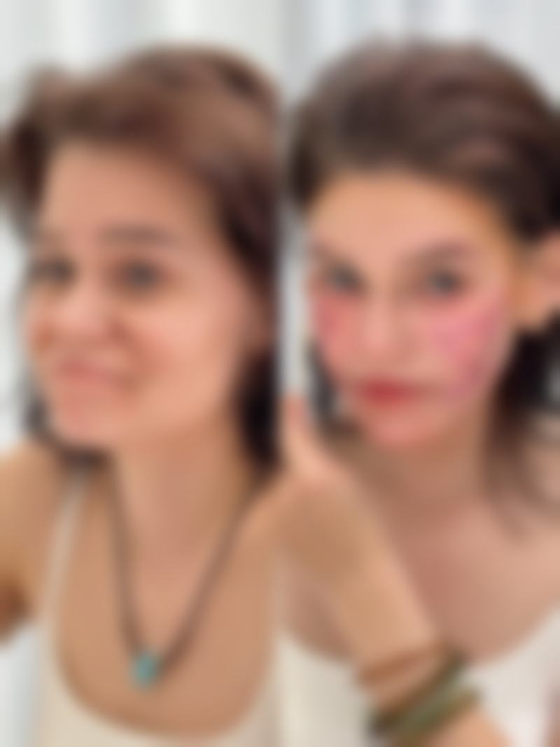 【临夏姜医生医疗美容诊所是正规的吗?】