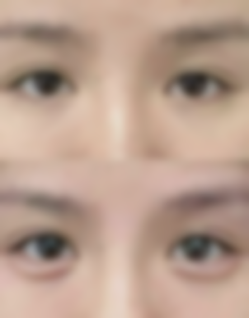 【深圳雅美医疗美容诊所特色项目：】