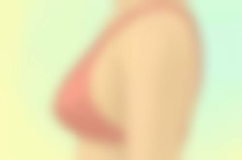 阴道紧缩术的成效分析