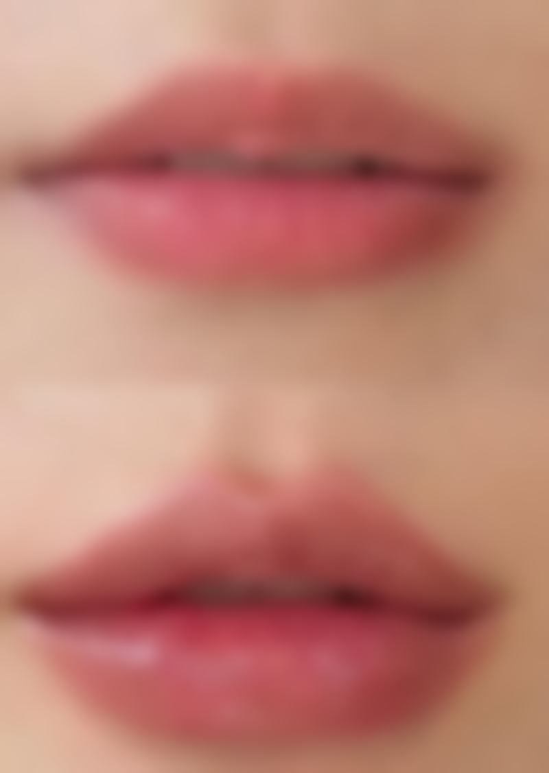 打Botox除皱要多久才能见效