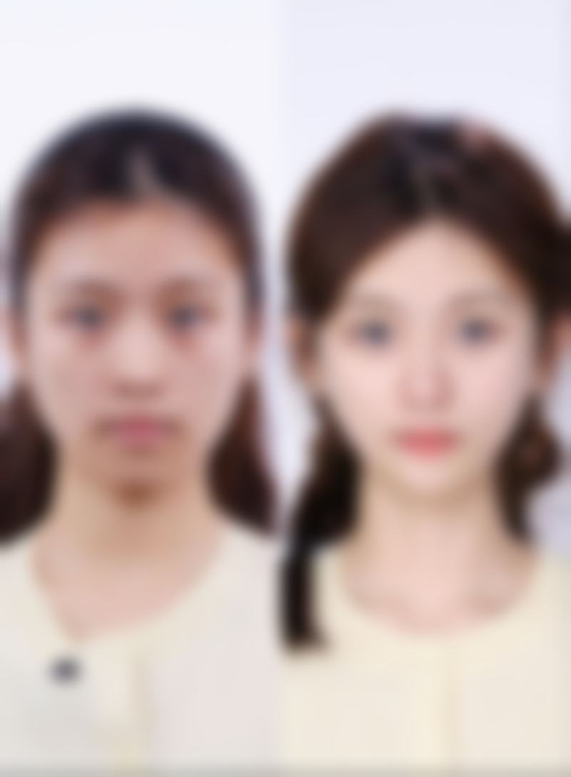 【通化狄波整形医疗美容诊所特色项目：】