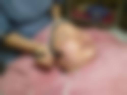 【郑州轻零整形医院核心优势：】