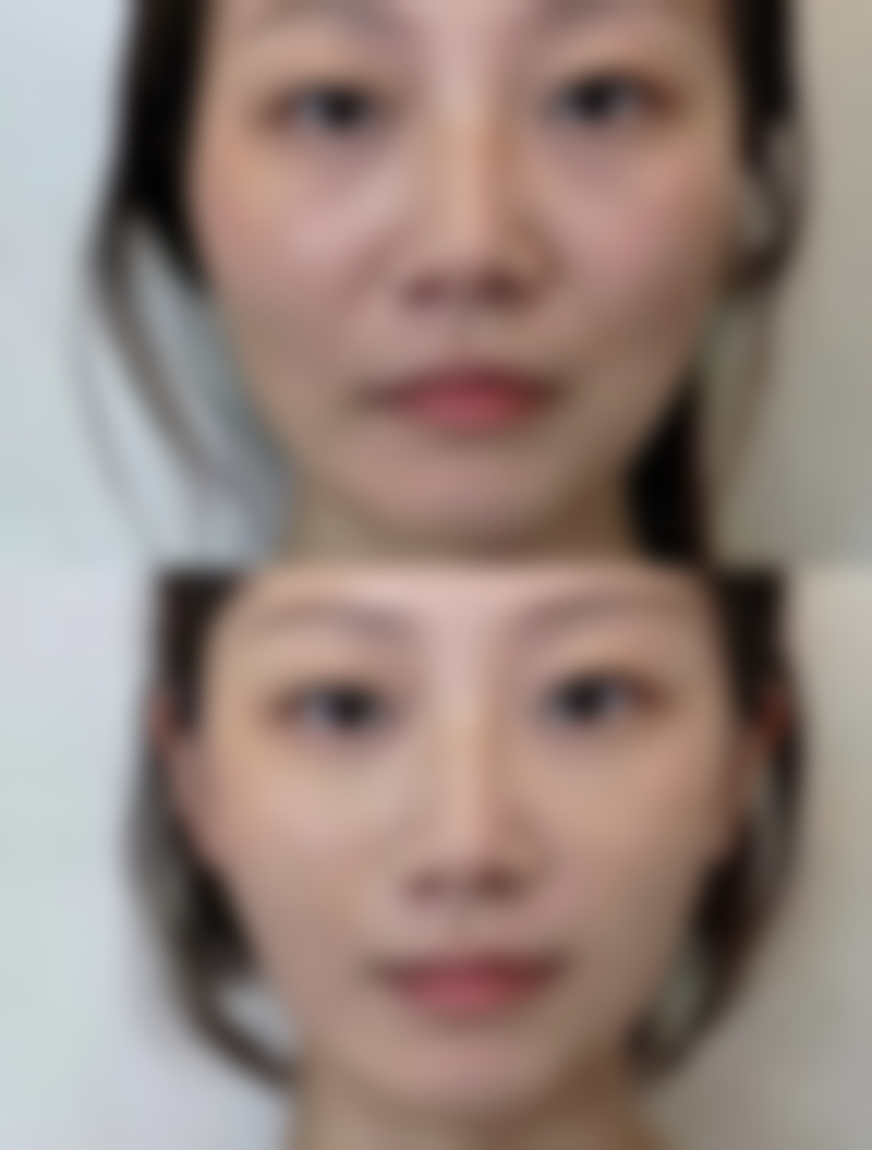 以下是武汉德济医院部分项目的参考价格表（价格仅供参考，实际以到院面诊为准）：