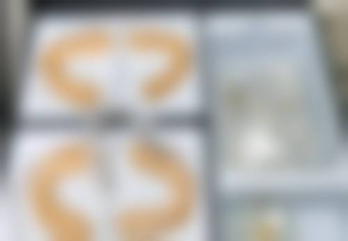 瘦脸针多少钱一次，要打几次定型