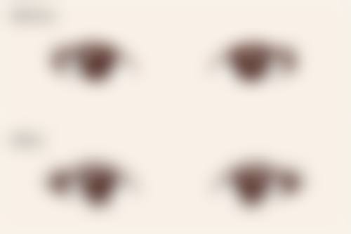 瘦脸针打一针成效明显吗