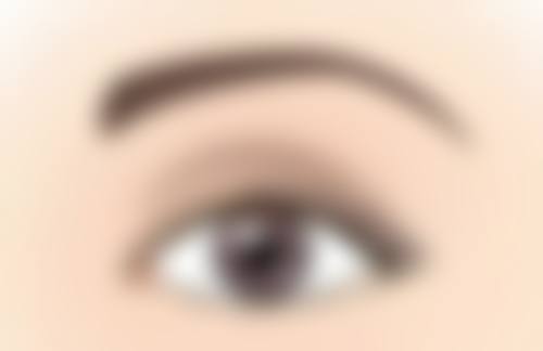 除皱手术一般几天见效