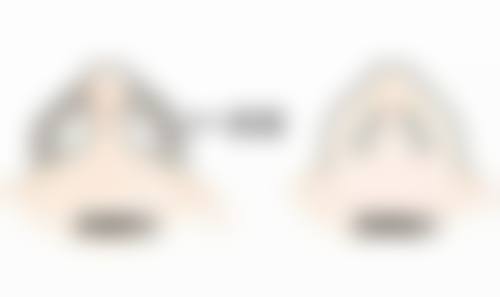 三次瘦脸针可以定型吗女