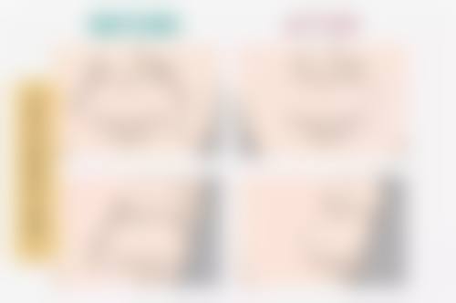 打美白针真的能美白吗？