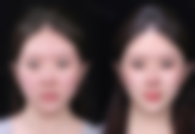 【福州哲诺沃(国内外)整形美容医院特色项目:】