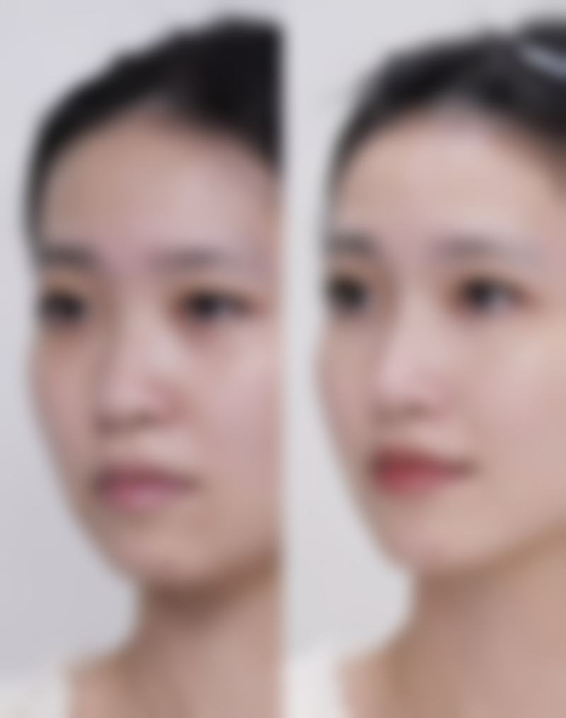 【合肥庞博整形医院患者口碑评价：】