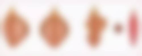 种植头发对身体有伤害吗