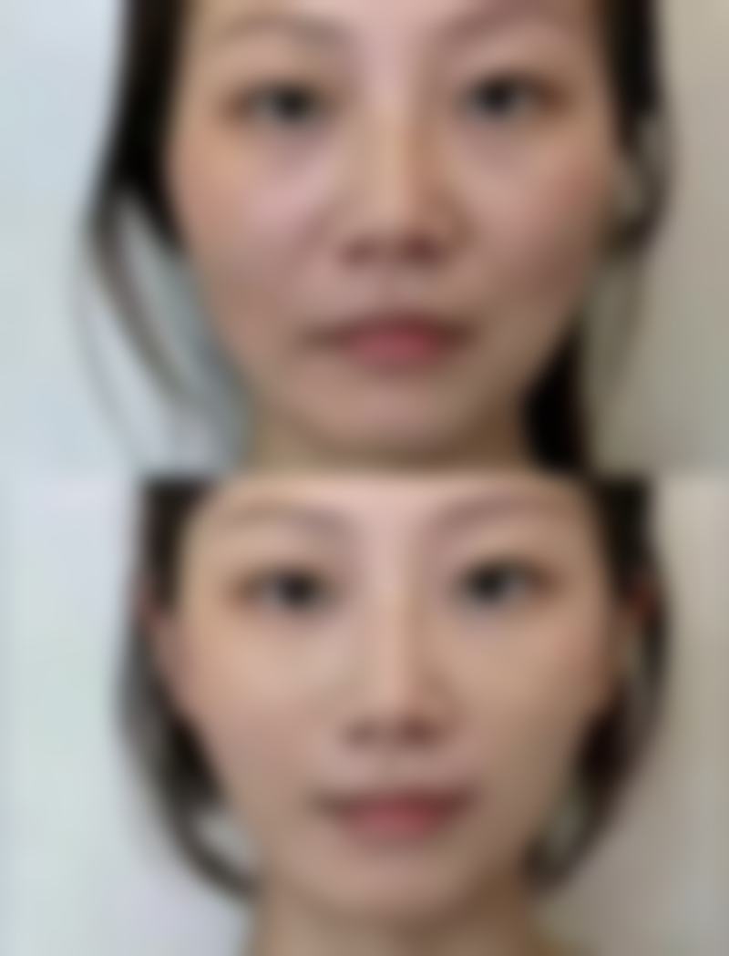 【北京丽格稙云医疗美容诊所特色项目:】