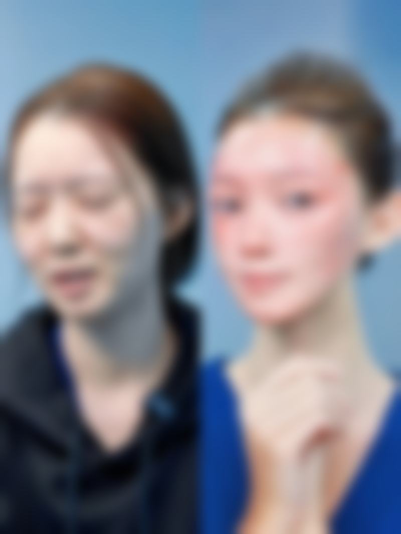 长期打瘦脸针有什么危害吗