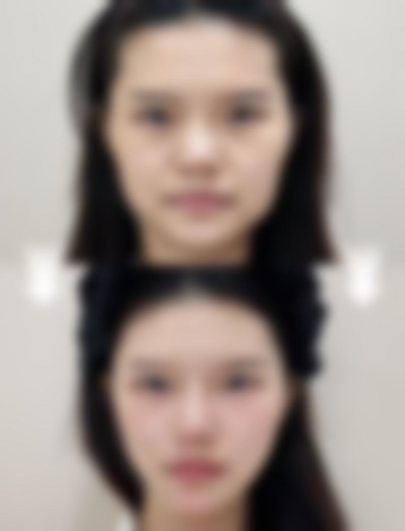 【广西 南宁伊莱美整形医院特色项目：】