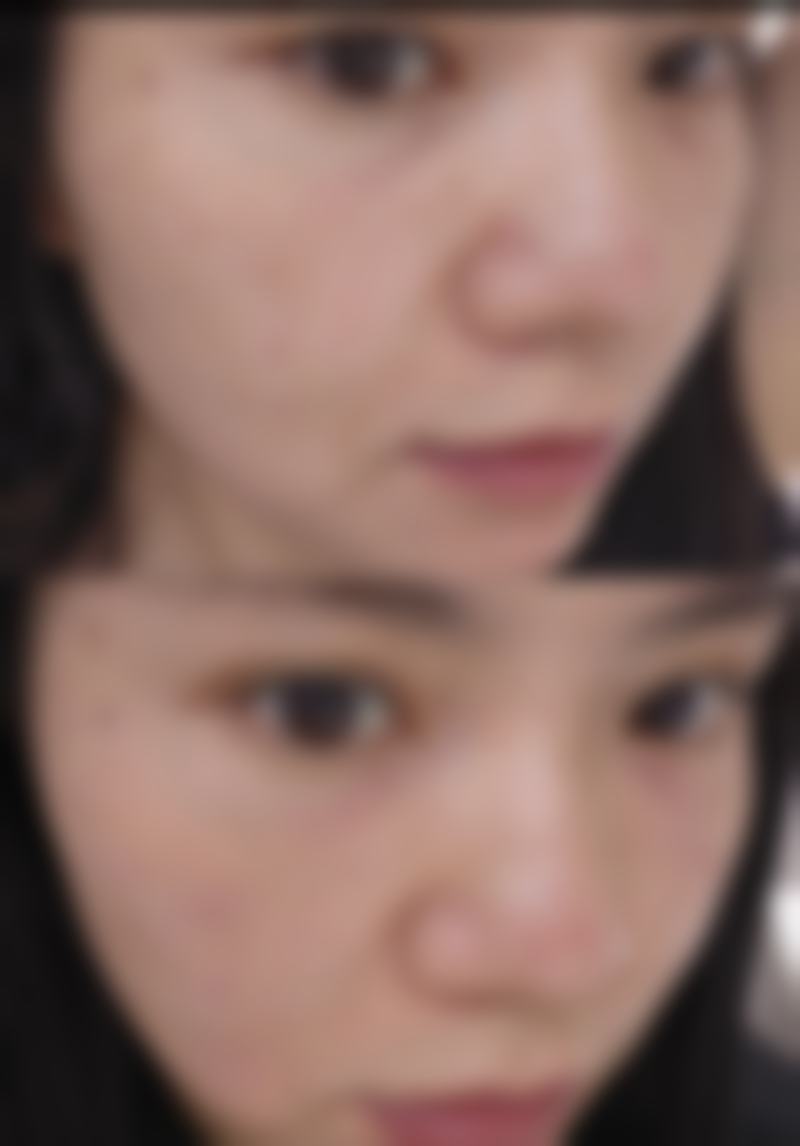 【厦门爱思特张敏整形医生团队：】