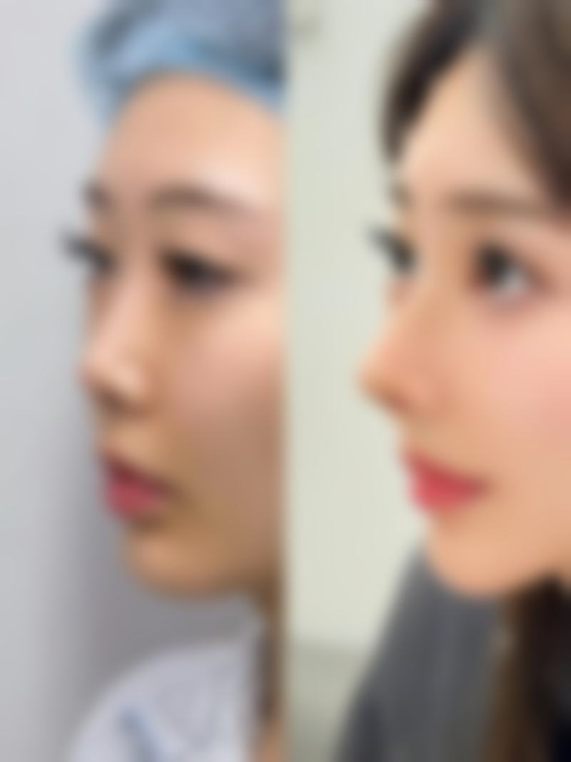 【朴珉炯医生技术特点】