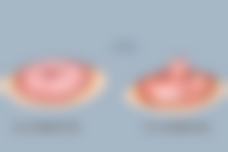 头发种植价格一般多少钱