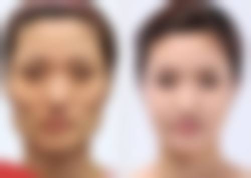 【上海康奥医疗美容医院特色项目：】