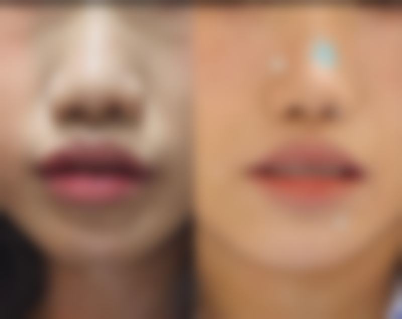 门诊部的环境也非常舒适。内部装修简洁大方，干净整洁。候诊区设有舒适的沙发、饮水机等设施，让患者在等待过程中感到放松。治疗室和手术室都严格按照卫生标准进行消毒，确保患者的安心。