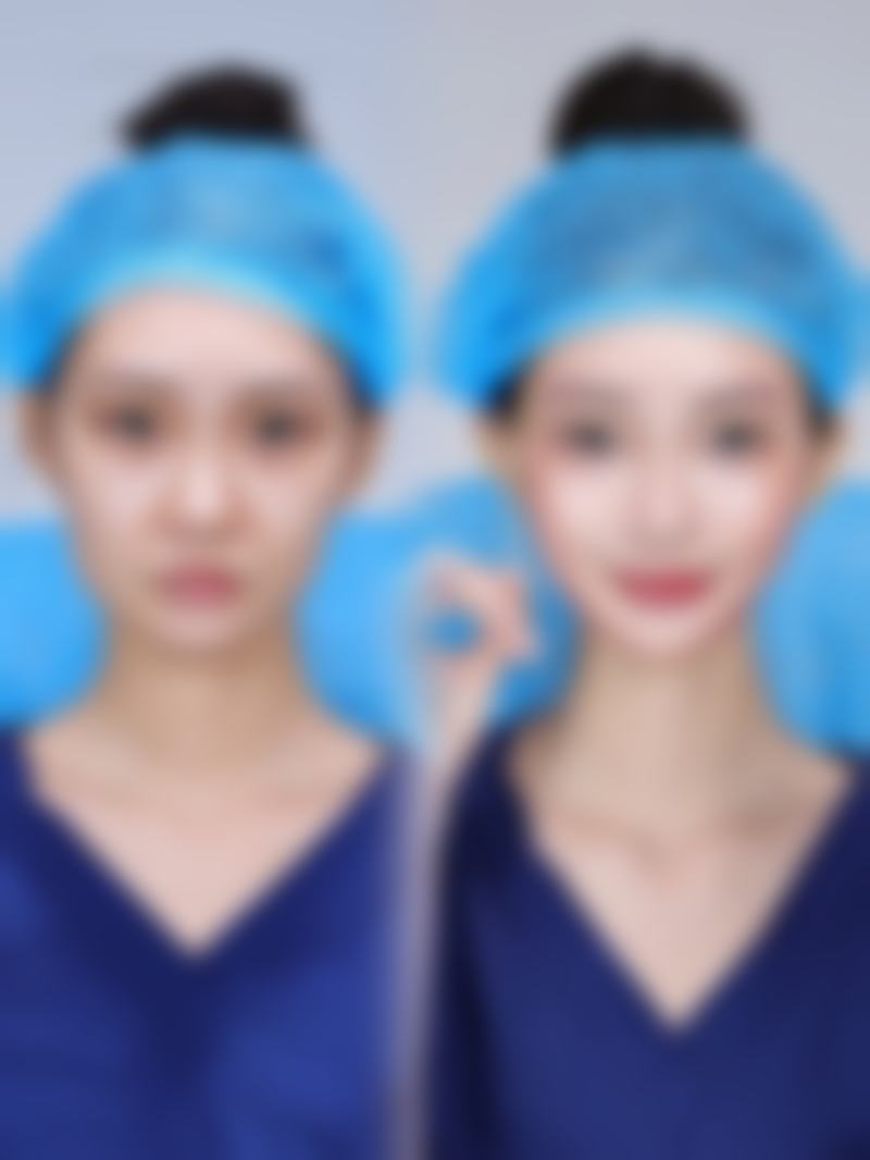 【南通俪人连天美植发整形科参考价格表：】