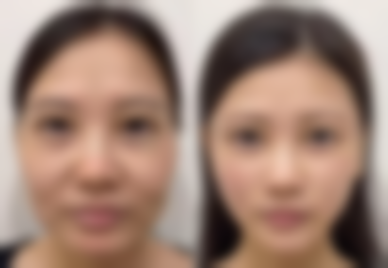 诊所的主刀医师毕业于大连医 科 大学，有着丰富的整形经验。他曾在多家大型整形医院工作过，并且多次前往韩国、日本、台湾等地进修与交流，接触到了国内外上精良的整形理念和技术。凭借着专精的知识和不错的技艺，能够为患者制定出个性化的整形方案，确保手术成效优良。