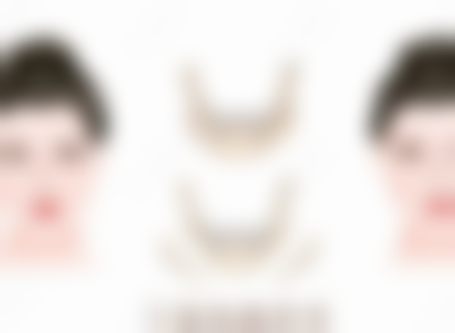 瘦脸针打一次维持多久