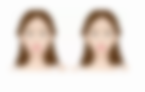 瘦脸针30单位是什么意思