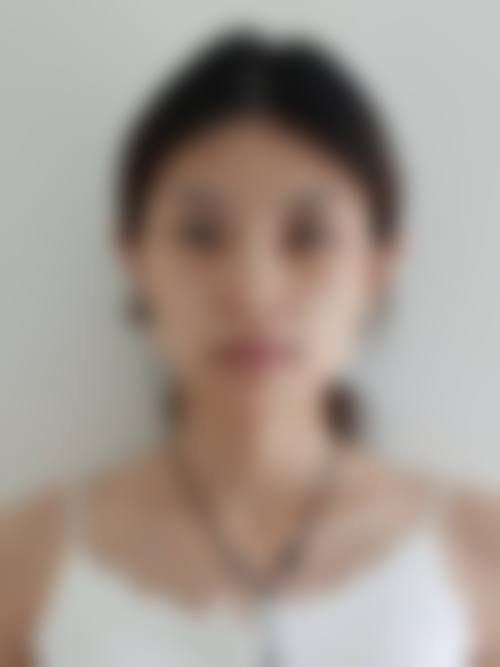 【庆阳润百灵医疗美容诊所核心优势：】