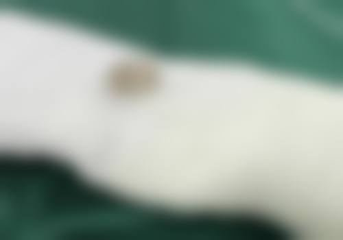 扬州市施博士医疗美容门诊部参考价格表：