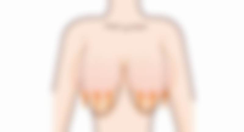 【李春明医生怎么预约挂号？】