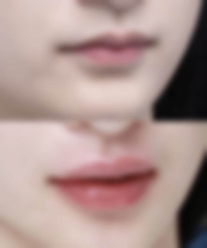 【珠海市艾尚美医疗美容门诊部参考价格表：】