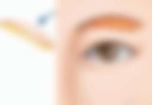 打除皱针的注意事项