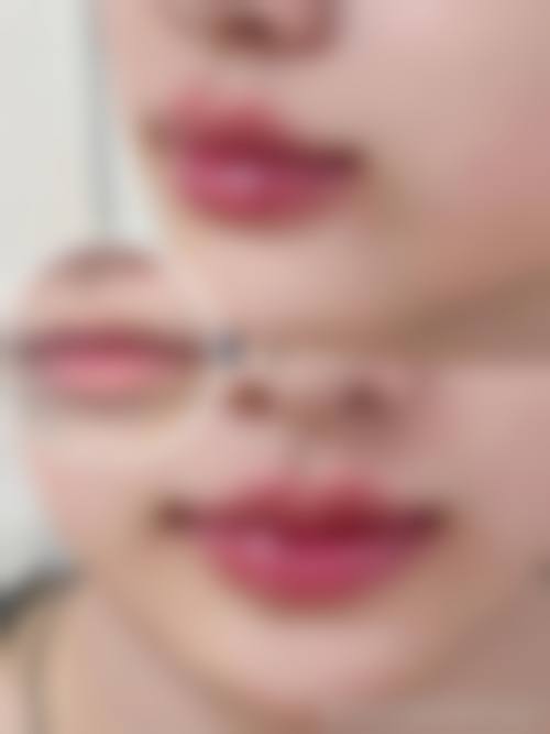 【elliot皮肤科诊疗设备：】