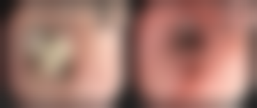 【南通旭美医疗美容门诊部参考价格表：】