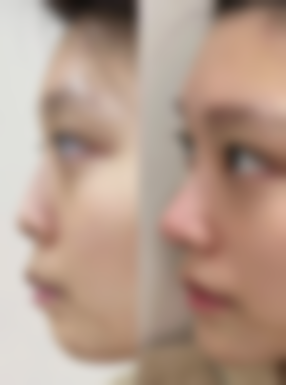 【梧州市人民医院烧伤整形外科怎么预约挂号?】