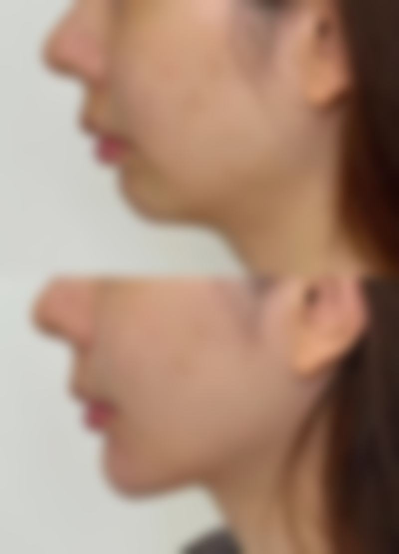 【西安慕尚星医疗美容诊所特色项目：】