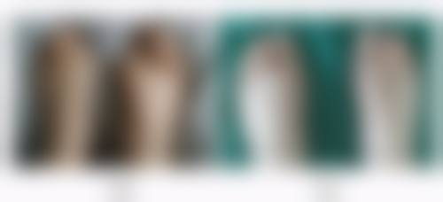 种植头发需要几个小时