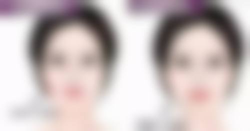 除皱针维持多久修复原来的样子