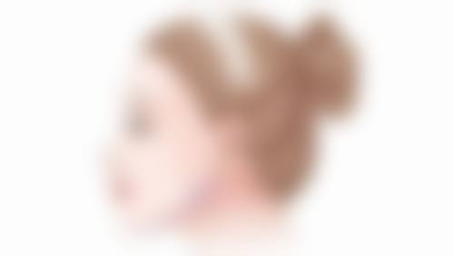 种植头发要注意事项