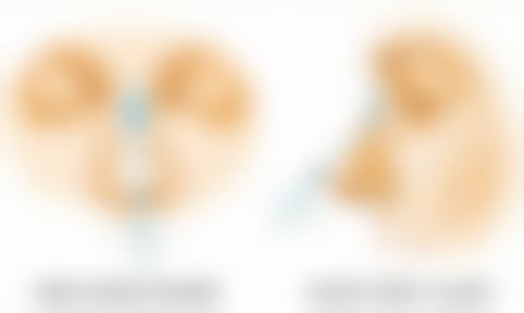 如生天使针的成分、规格、功效和维持时间