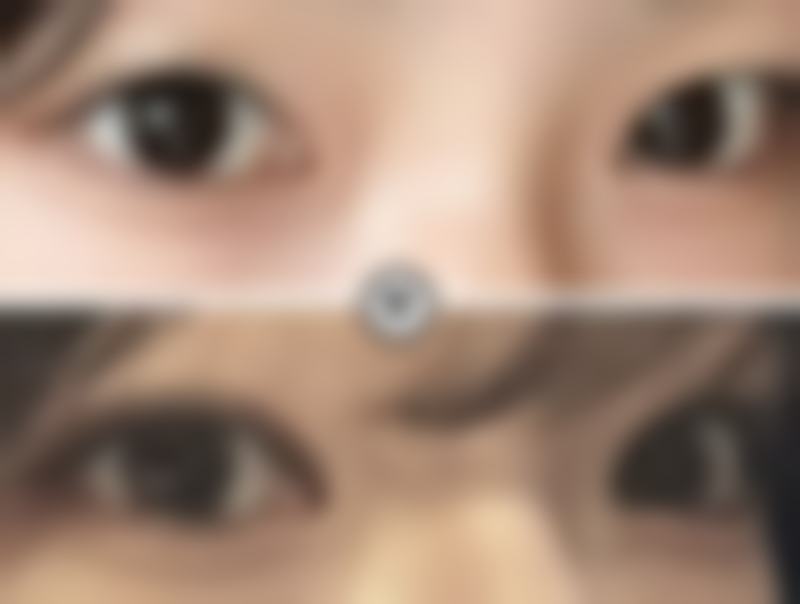 【刘黎阳医生怎么预约挂号？】