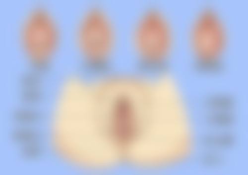 瘦脸针多少钱一针